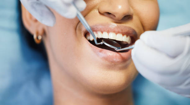 Best Emergency Root Canal Therapy in Contoocook, NH