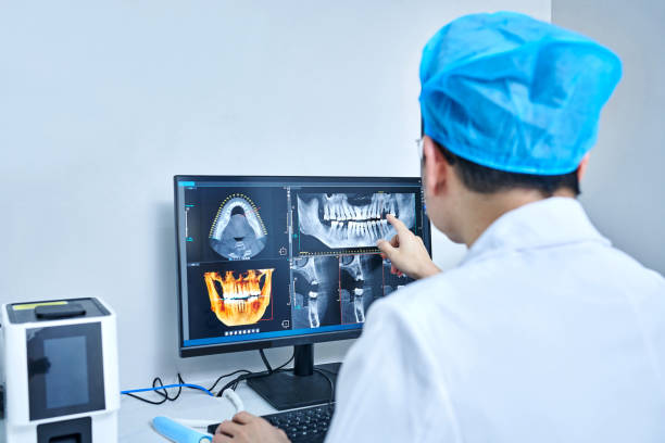 Best Knocked-Out Tooth (Avulsed Tooth) Treatment in Contoocook, NH